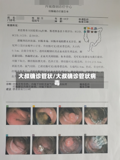 大叔确诊管状/大叔确诊管状病毒