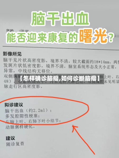 【怎样确诊脑瘤,如何诊断脑瘤】