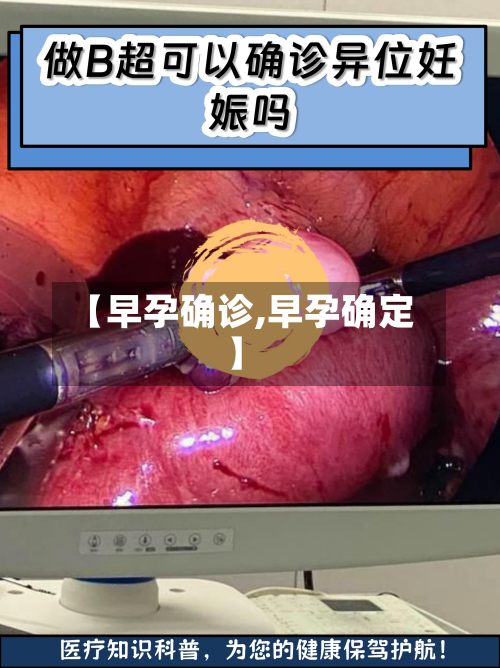【早孕确诊,早孕确定】-第3张图片