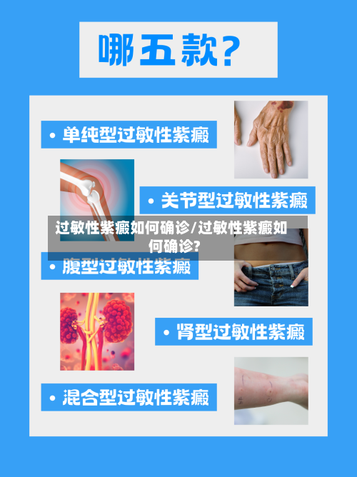 过敏性紫癜如何确诊/过敏性紫癜如何确诊?
