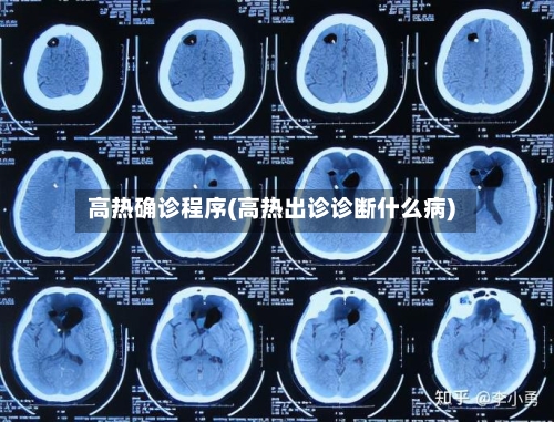 高热确诊程序(高热出诊诊断什么病)-第2张图片