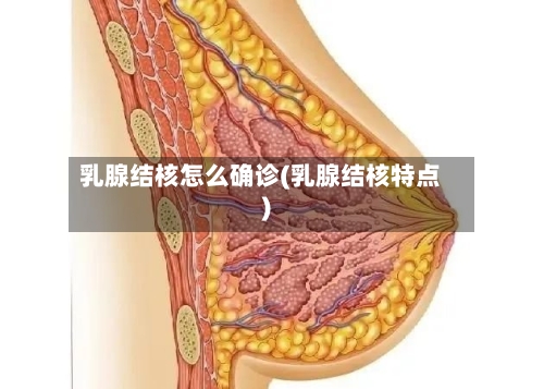 乳腺结核怎么确诊(乳腺结核特点)