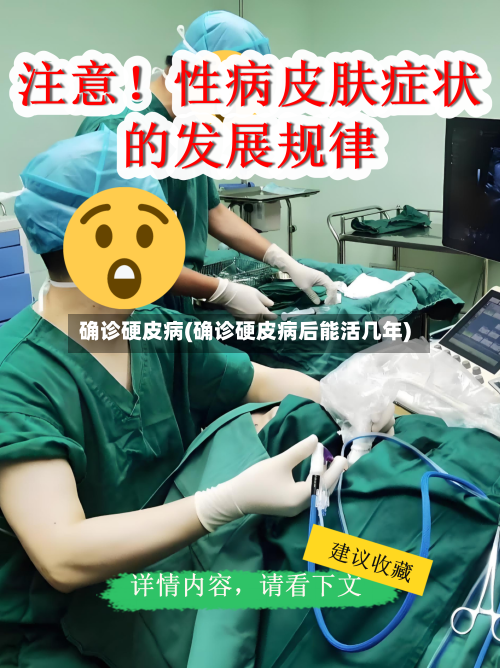 确诊硬皮病(确诊硬皮病后能活几年)