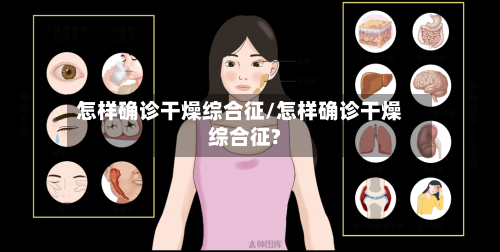 怎样确诊干燥综合征/怎样确诊干燥综合征?