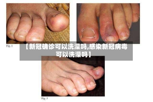【新冠确诊可以洗澡吗,感染新冠病毒可以洗澡吗】-第2张图片
